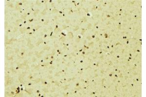 ABIN6276552 at 1/100 staining Mouse brain tissue by IHC-P.