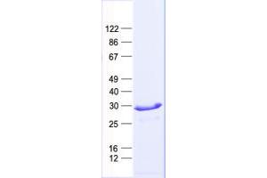 Western Blotting (WB) image for F-Box Protein 44 (FBXO44) protein (His tag) (ABIN2720967)