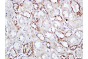 Formalin-fixed and paraffin embedded human kidney labeled with Rabbit Anti-NNT Polyclonal Antibody, Unconjugated  at 1:200 followed by conjugation to the secondary antibody and DAB staining