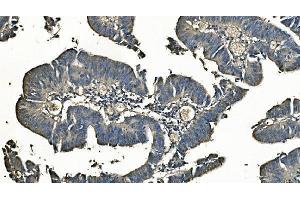 IHC analysis of Carbonic Anhydrase I/CA1 using anti-Carbonic Anhydrase I/CA1 antibody (ABIN7602621). (CA1 Antikörper  (AA 9-261))