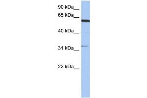 WB Suggested Anti-CDKL2 Antibody Titration: 0.