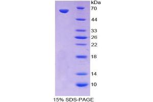 Image no. 1 for Protein Kinase C, theta (PRKCQ) (AA 380-634) protein (His tag,GST tag) (ABIN6237912) (PKC theta Protein (AA 380-634) (His tag,GST tag))