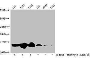 Western Blot Detected samples: 293 whole cell lysate, A549 whole cell lysate, K562 whole cell lysate, Untreated (-) or treated (+) with 30 mM sodium butyrate for 4h All lanes: HIST1H2BC antibody at 1:100 Secondary Goat polyclonal to rabbit IgG at 1/50000 dilution Predicted band size: 14 kDa Observed band size: 14 kDa