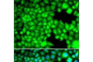Immunofluorescence analysis of U2OS cells using FABP3 Polyclonal Antibody (FABP3 Antikörper)