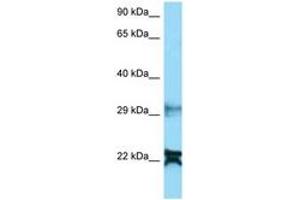 Image no. 1 for anti-NADH Dehydrogenase (Ubiquinone) 1 alpha Subcomplex, 8, 19kDa (NDUFA8) (AA 25-74) antibody (ABIN6748389)