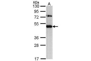 WB Image Sample (30 ug of whole cell lysate) A: H1299 10% SDS PAGE antibody diluted at 1:1000 (TRAM1 Antikörper  (C-Term))