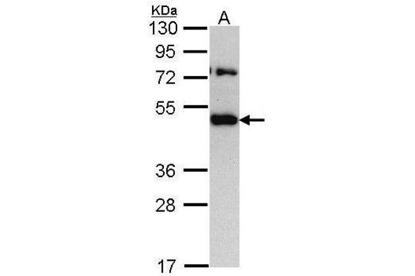TRAM1 抗体  (C-Term)