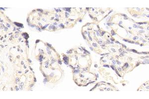 Detection of FN3K in Human Placenta Tissue using Polyclonal Antibody to Fructosamine-3-Kinase (FN3K) (FN3K Antikörper  (AA 1-309))
