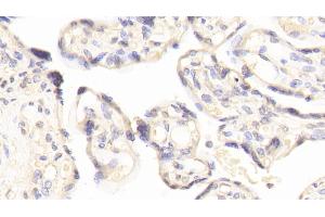 Detection of FN3K in Human Placenta Tissue using Polyclonal Antibody to Fructosamine-3-Kinase (FN3K)