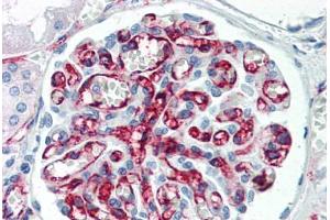 Human Kidney (formalin-fixed, paraffin-embedded) stained with PECAM1 antibody ABIN337092 at 5 ug/ml followed by biotinylated anti-mouse IgG secondary antibody ABIN481714, alkaline phosphatase-streptavidin and chromogen. (CD31 Antikörper)