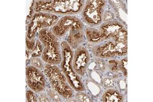 Immunohistochemical staining of human kidney with ASB8 polyclonal antibody  show strong cytoplasmic positivity in cells in tubules. (ASB8 Antikörper)