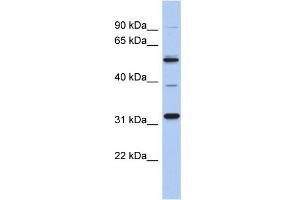 WB Suggested Anti-MGC51025 Antibody Titration: 0. (TBC1D26 Antikörper  (Middle Region))