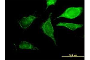 Immunofluorescence (IF) image for anti-Glutaryl-CoA Dehydrogenase (GCDH) (AA 1-438) antibody (ABIN515979)