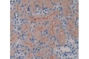 IHC-P analysis of kidney tissue, with DAB staining. (SPTLC3 Antikörper  (AA 80-563))