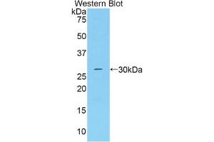 Western blot analysis of the recombinant protein. (Adipsin Antikörper  (AA 1-263))