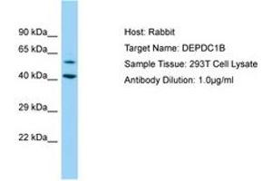 Image no. 1 for anti-DEP Domain Containing 1B (DEPDC1B) (AA 87-136) antibody (ABIN6750177) (DEPDC1B Antikörper  (AA 87-136))