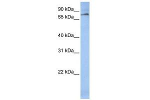 WB Suggested Anti-ALOX12 Antibody Titration: 0. (ALOX12 Antikörper  (C-Term))
