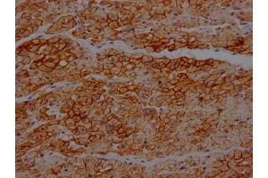 IHC image of ABIN7127460 diluted at 1:100 and staining in paraffin-embedded human heart tissue performed on a Leica BondTM system. (Rekombinanter Dystrophin Antikörper)