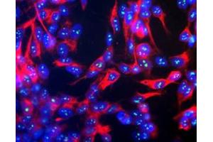 Immunofluorescence of Anti-Fibrillarin (Mouse) Antibody Immunofluorescence Microscopy of Anti-Fibrillarin (Mouse) Antibody. (Fibrillarin Antikörper)