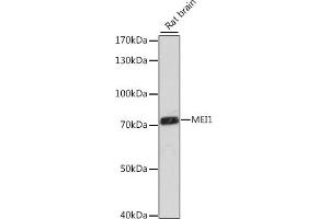 Western blot analysis of extracts of rat brain, using MEI1 antibody (ABIN7268447) at 1:1000 dilution. (MEI1 Antikörper  (AA 1000-1170))