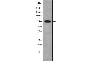 Western blot analysis of PAK5/6 using COLO whole cell lysates (PAK7 Antikörper  (C-Term))