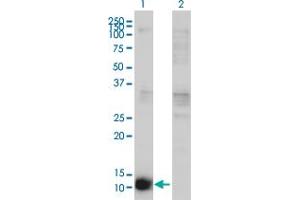 Western Blot analysis of CSTB expression in transfected 293T cell line by CSTB monoclonal antibody (M02), clone M2-F1. (CSTB Antikörper  (AA 1-98))