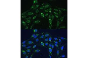 Immunofluorescence analysis of U-2 OS cells using COX6 Polyclonal Antibody (ABIN6132108, ABIN6138915, ABIN6138916 and ABIN6220368) at dilution of 1:100 (40x lens). (COX6A1 Antikörper  (AA 25-109))