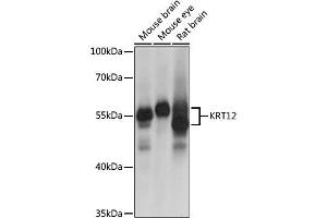 Western blot analysis of extracts of various cell lines, using KRT12 antibody (ABIN6134130) at 1:1000 dilution.