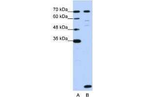 WB Suggested Anti-LSM2 Antibody Titration:  1. (LSM2 Antikörper  (Middle Region))