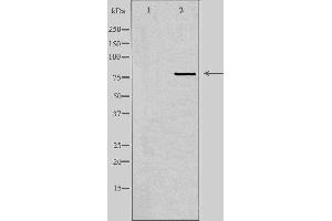 Western blot analysis of extracts from HuvEc cells, using KCNQ4 antibody.