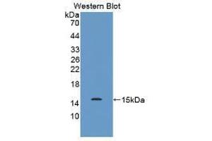 Western blot analysis of the recombinant protein. (MUC2 Antikörper  (AA 5075-5179))