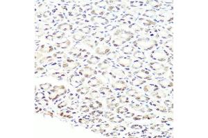 Immunohistochemistry of paraffin-embedded mouse stomach using PRPF8 antibody (ABIN5973594) at dilution of 1/100 (40x lens). (PRPF8 Antikörper)