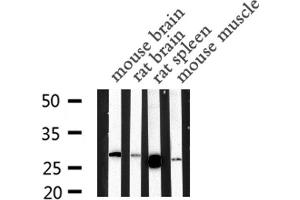 Western blot analysis of MBL2 expression in various lysates (MBL2 Antikörper  (N-Term))