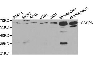 Western blot analysis of extracts of various cell lines, using CASP6 antibody. (Caspase 6 Antikörper  (AA 24-293))