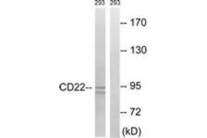 Western blot analysis of extracts from 293 cells, treated with Ca2+ 40nM 30', using BL-CAM (Ab-807) Antibody. (CD22 Antikörper  (AA 776-825))