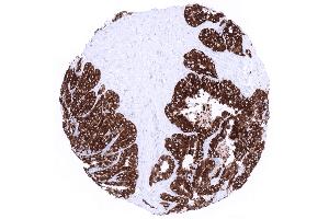 Seminal vesicle epithelial cells exhibit high level MUC6 expression (Rekombinanter MUC6 Antikörper)