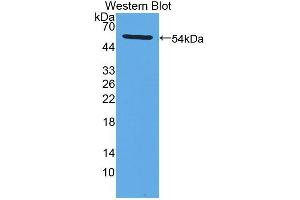 Western blot analysis of the recombinant protein. (LPCAT1 Antikörper  (AA 301-514))