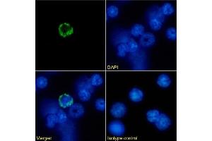 Immunofluorescence staining of mouse splenocytes using anti-MHC I antibody R1-21.