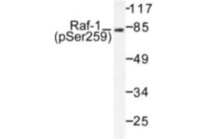 Image no. 1 for anti-V-Raf-1 Murine Leukemia Viral Oncogene Homolog 1 (RAF1) (pSer259) antibody (ABIN318109) (RAF1 Antikörper  (pSer259))