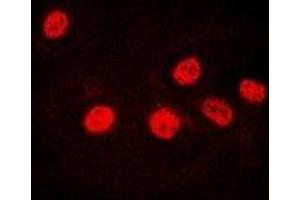Immunofluorescent analysis of Ikaros staining in U2OS cells. (IKZF1 Antikörper)