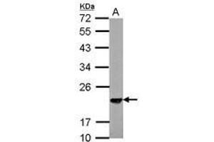 Image no. 2 for anti-S-Phase Kinase-Associated Protein 1 (SKP1) (AA 1-163) antibody (ABIN1500944)