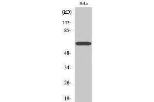 Western Blotting (WB) image for anti-Nuclear Factor-kB p65 (NFkBP65) (Thr74) antibody (ABIN6283944)