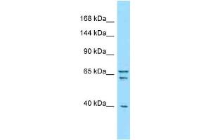 Western Blotting (WB) image for anti-Piccolo (Presynaptic Cytomatrix Protein) (PCLO) (C-Term) antibody (ABIN2789740)