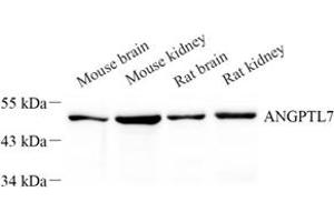 Western blot analysis of Angptl7 (ABIN7073049) at dilution of 1: 500 (ANGPTL7 Antikörper)