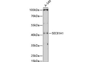 Western blot analysis of extracts of A-549 cells, using SEC61 Antibody (1614) at 1:3000 dilution. (SEC61A1 Antikörper  (AA 310-420))