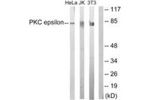 Western blot analysis of extracts from HeLa/Jurkat/3T3 cells, treated with PMA 125ng/ml 30', using PKC epsilon (Ab-729) Antibody. (PKC epsilon Antikörper  (AA 688-737))