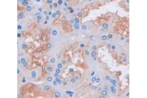 IHC-P analysis of Kidney tissue, with DAB staining. (CMTM1 Antikörper  (AA 1-286))