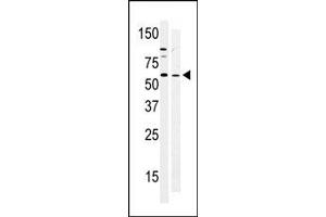 Western Blotting (WB) image for anti-PTK6 Protein tyrosine Kinase 6 (PTK6) (N-Term) antibody (ABIN359990)