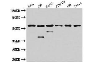 Western Blot Positive WB detected in: Hela whole cell lysate, 293 whole cell lysate, HepG2 whole cell lysate, NIH/3T3 whole cell lysate, LO2 whole cell lysate, Mouse brain tissue All lanes: PKM antibody at 4. (PKM Antikörper  (AA 185-461))