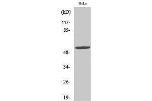 Western Blotting (WB) image for anti-Cytochrome P450, Family 2, Subfamily A, Polypeptide 13 (CYP2A13) (Internal Region) antibody (ABIN3184172) (CYP2A13 Antikörper  (Internal Region))